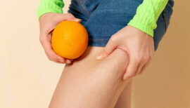 femme tenant sa peau pour montrer la cellulite